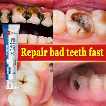 Паста за зъби, за избелване на зъби, Бързо възстановяване на зъбния кариес, Премахване на петна плака, Кариес, Свеж дъх, Премахване на зъбната плака, Възстановяване на зъбите